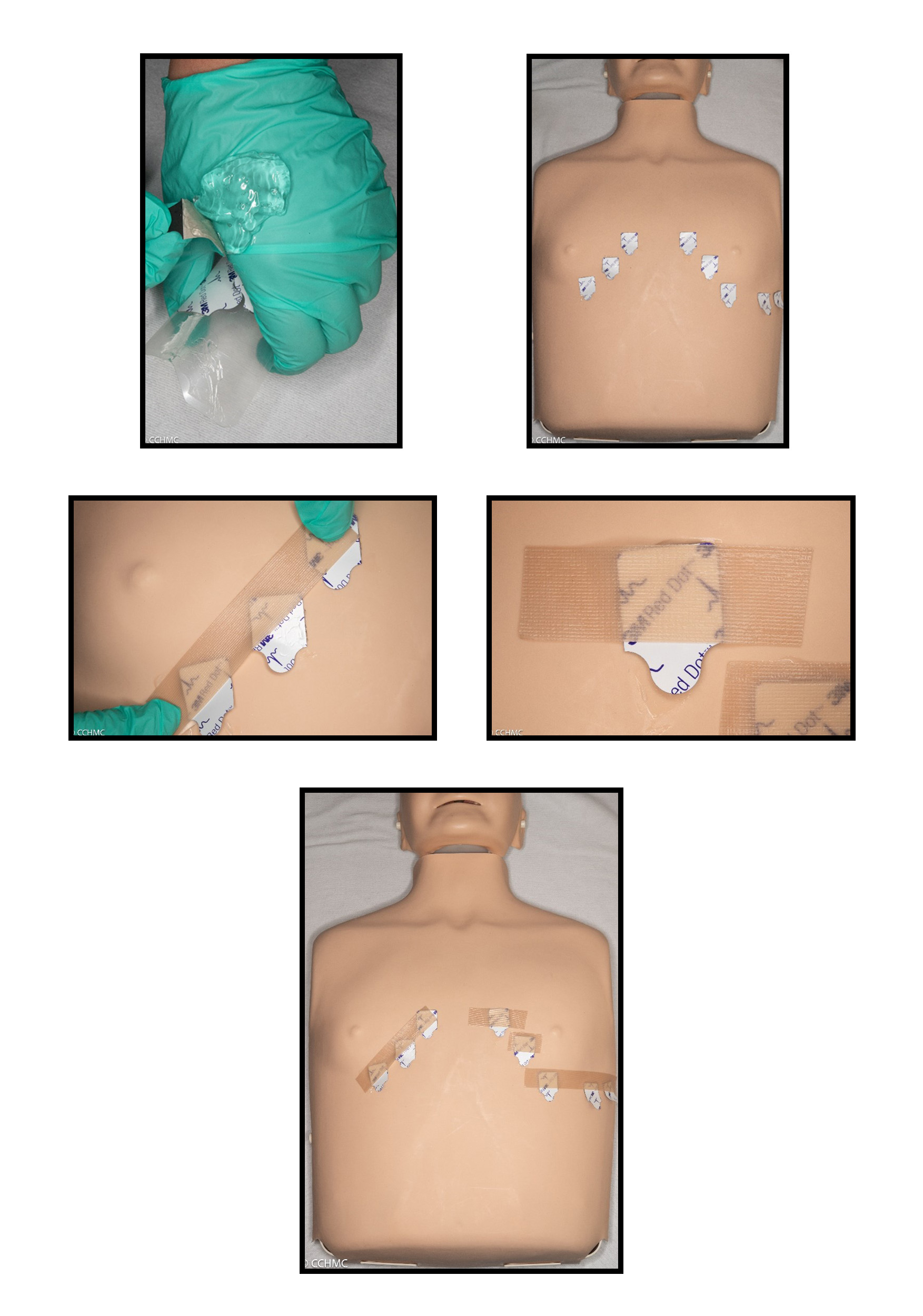 EKGs with ultrasound gel