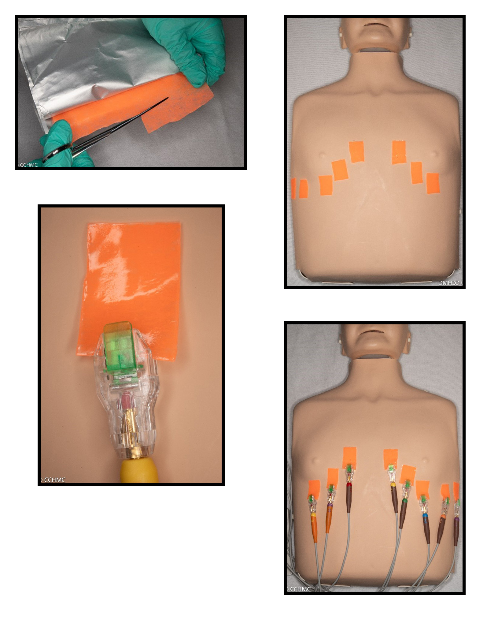 EKGs